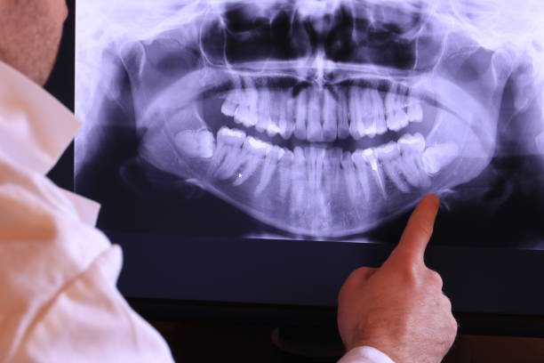Best Emergency Denture Repair in Miramar, FL
